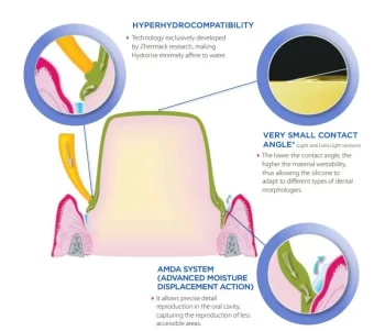 Zhermack Hydrorise Putty Normal Set - Image 3