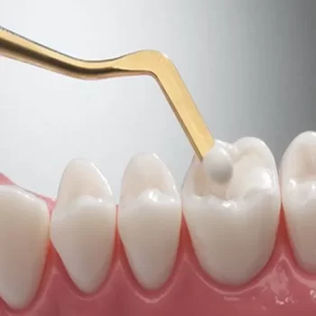 GDC Composite Instrument Gold Titanium -6 (CIG1) - Image 3