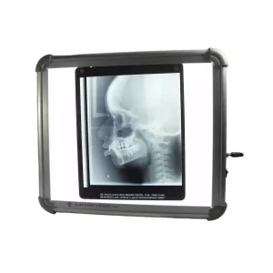 SLIM LED X-Ray Viewer OPG 10″x12″