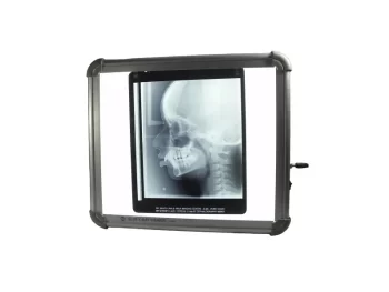 SLIM LED X-Ray Viewer OPG 10″x12″