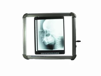 SLIM LED X-Ray Viewer OPG 10″x12″ - Image 2