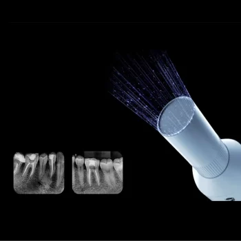 Woodpecker Ai Ray Portable X-Ray Machine - Image 4