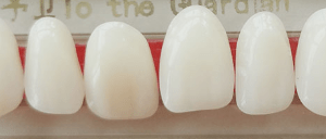 DD+ Synthetic Teeth Set of 6 Lower