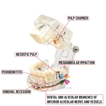 DD+ Education - Jaw Set With Implant - Image 2