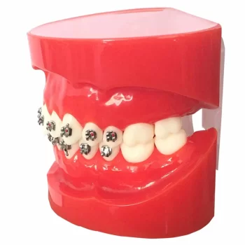 DD+ Ortho Education - Jaw Set [] - Image 4
