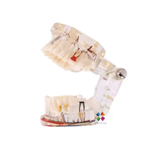 DD+ Education - Jaw Set With Implant