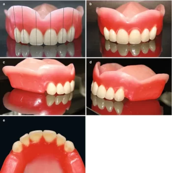 N I D PrestoRock Teethset A1 - Image 4